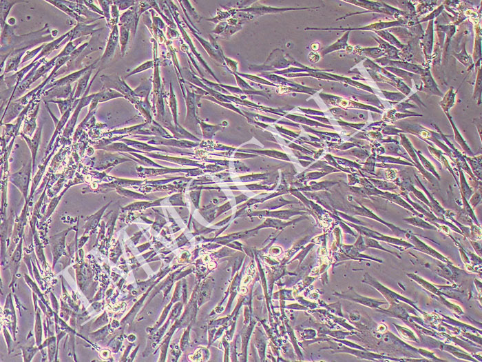 人脑血管平滑肌细胞永生化