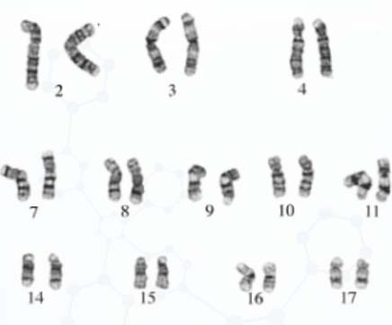 染色体核型分析结果图