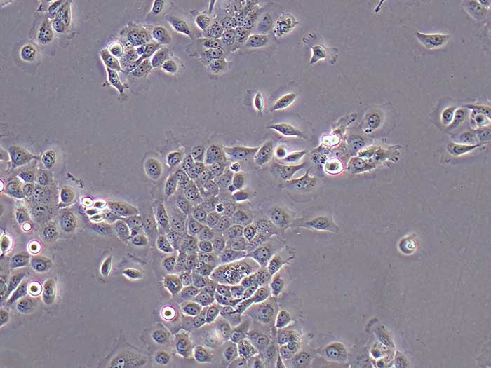 CaSki细胞细胞图片