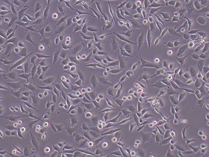 SiHa细胞细胞图片