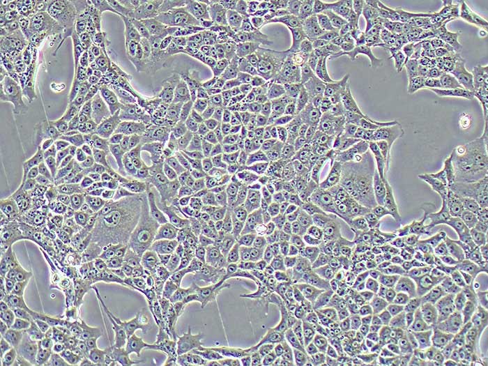RENCA细胞图片