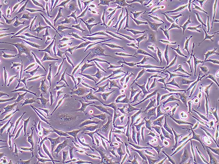 McCoy细胞细胞图片