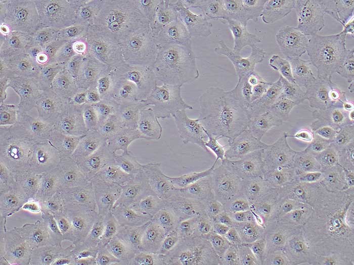 MARC-145细胞细胞图片