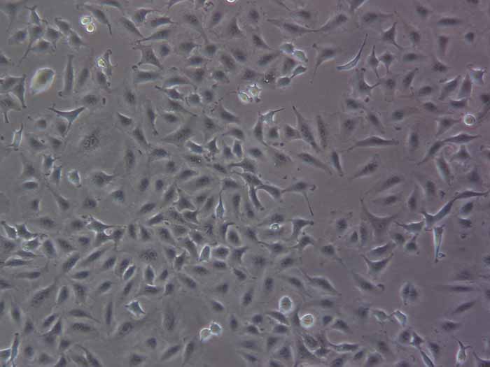 A549人非小细胞肺癌细胞（STR鉴定正确）图片