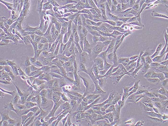 HOS细胞细胞图片