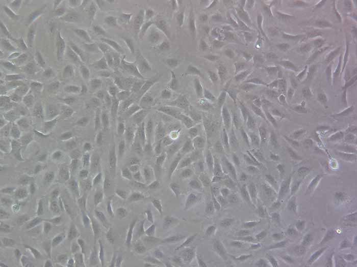 SJSA-1细胞细胞图片