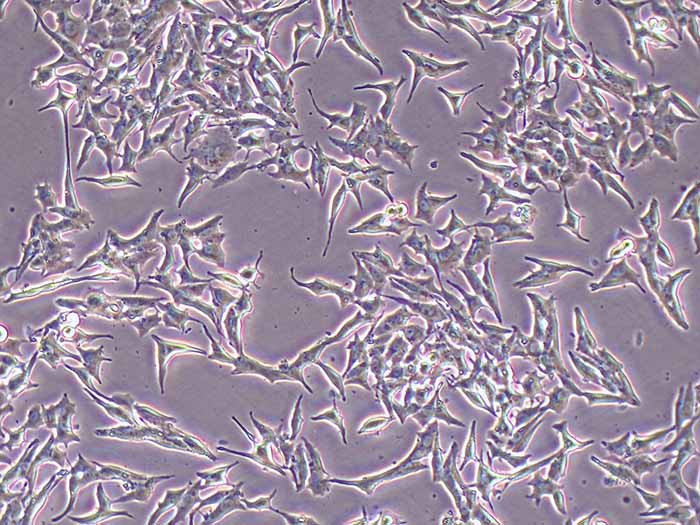 TTA1细胞图片