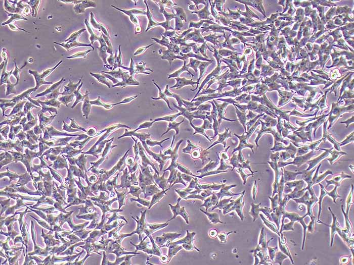 TTA1细胞图片