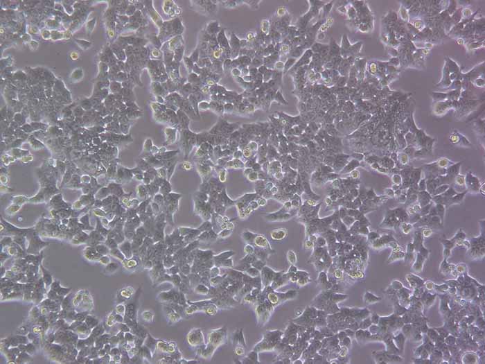 HCT-116细胞图片
