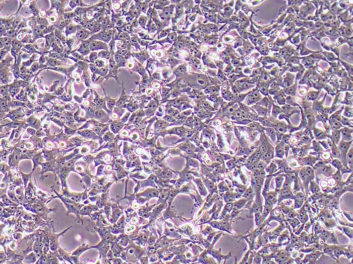 293FT细胞细胞图片
