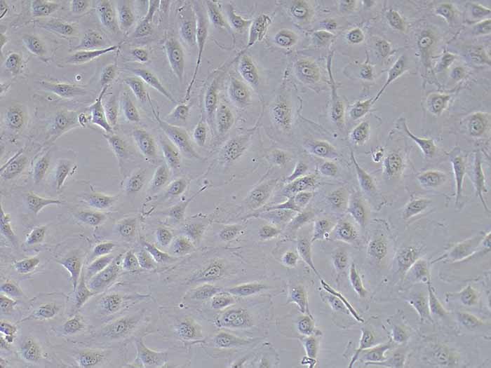HUVEC细胞细胞图片