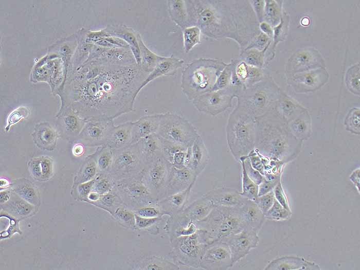 MKN-7细胞细胞图片