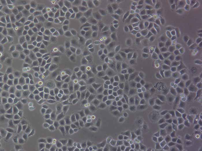 LO-2细胞细胞图片