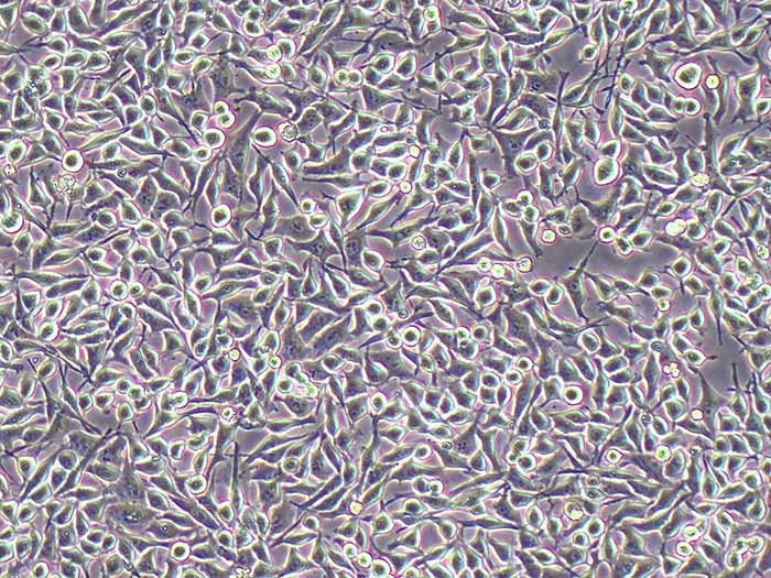 Bel-7405人肝癌细胞（STR鉴定正确）图片