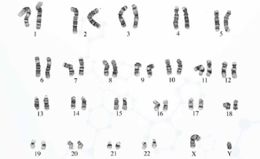 人类正常染色体核型图