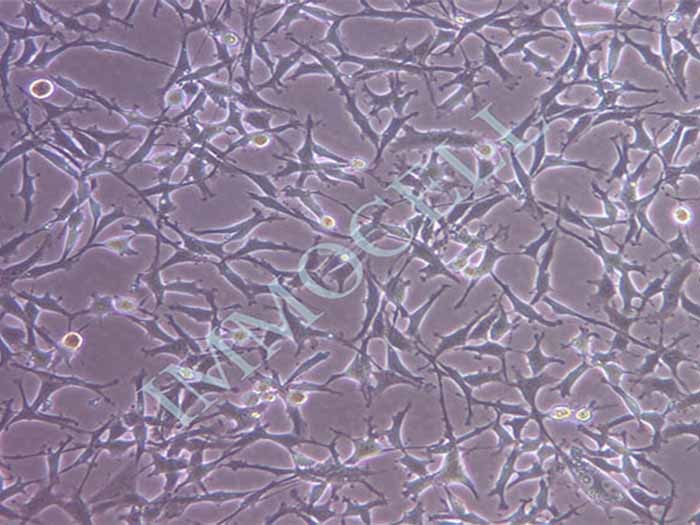 ES-2细胞图片