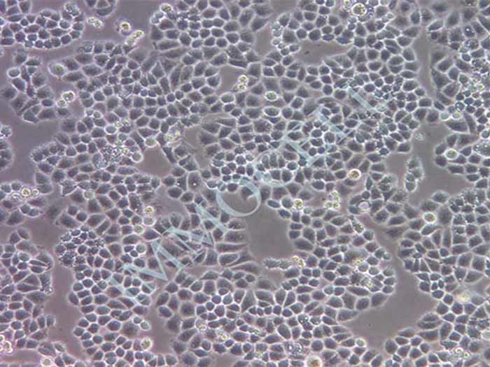 C33A细胞细胞图片