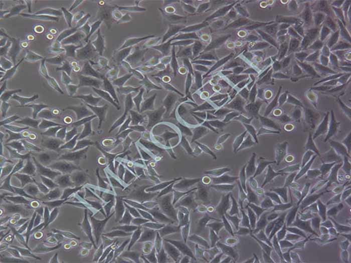 SMMC-7721细胞图片