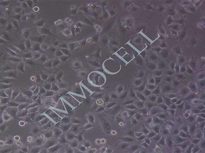 MGC-803细胞细胞图片