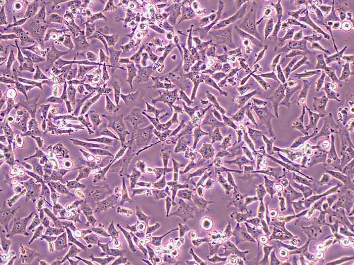 NCI-H446细胞细胞图片