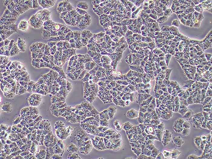 NCI-H460细胞细胞图片
