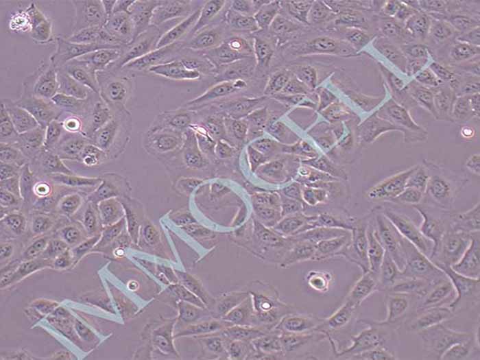 U2OS-LUC细胞细胞图片