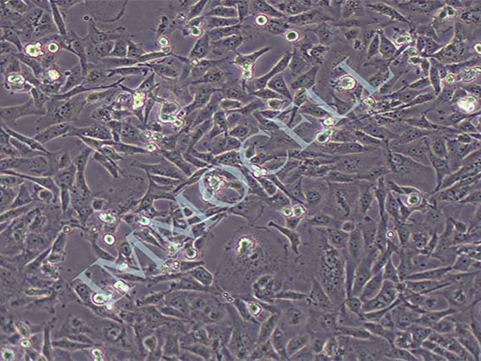 MDA-MB-468/ADR人乳腺癌阿霉素耐药细胞株（暂不提供）