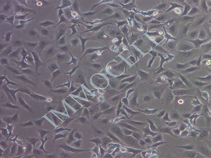 SKOV3-LUC细胞图片