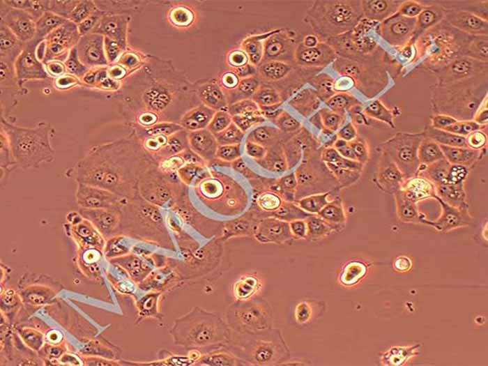 OVCAR-3细胞细胞图片