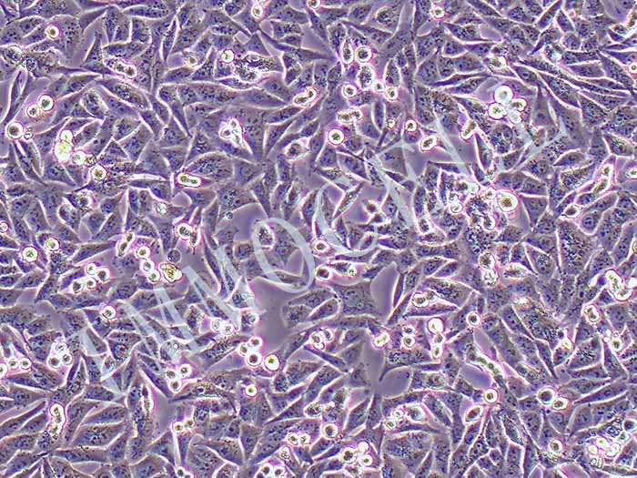 A375-eGFP人恶性黑色素瘤细胞图片