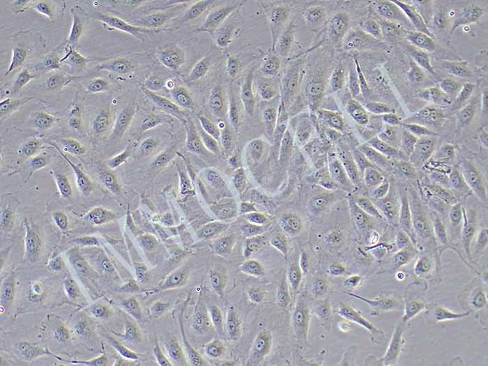 HUVEC-RFP细胞图片