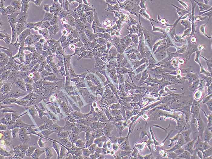人骨肉瘤细胞-荧光素酶标记图片