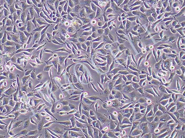 SIHA-LUC细胞图片